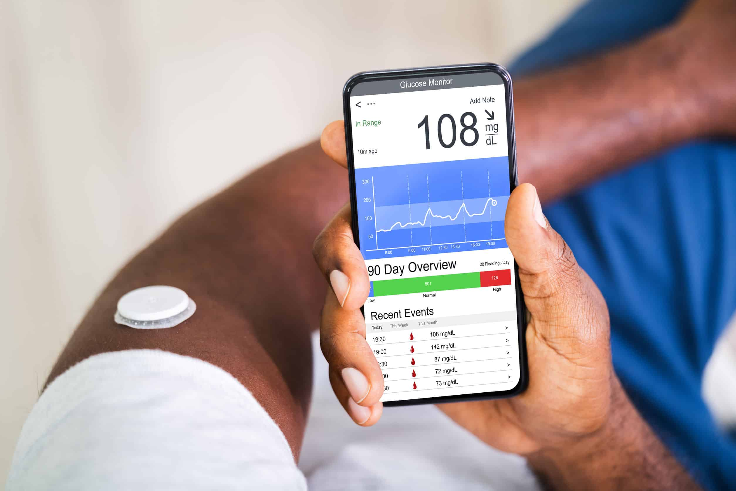 Continuous Glucose Monitoring for Athletes: Benefits of a CGM for
